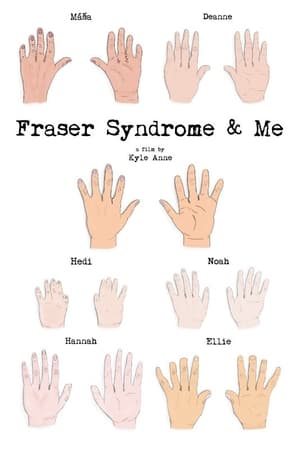 En dvd sur amazon Fraser Syndrome & Me