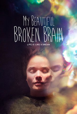 En dvd sur amazon My Beautiful Broken Brain