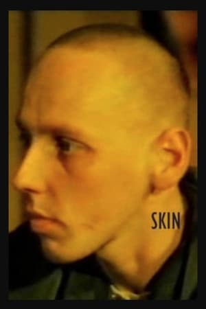 En dvd sur amazon Skin