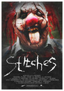 Stitches